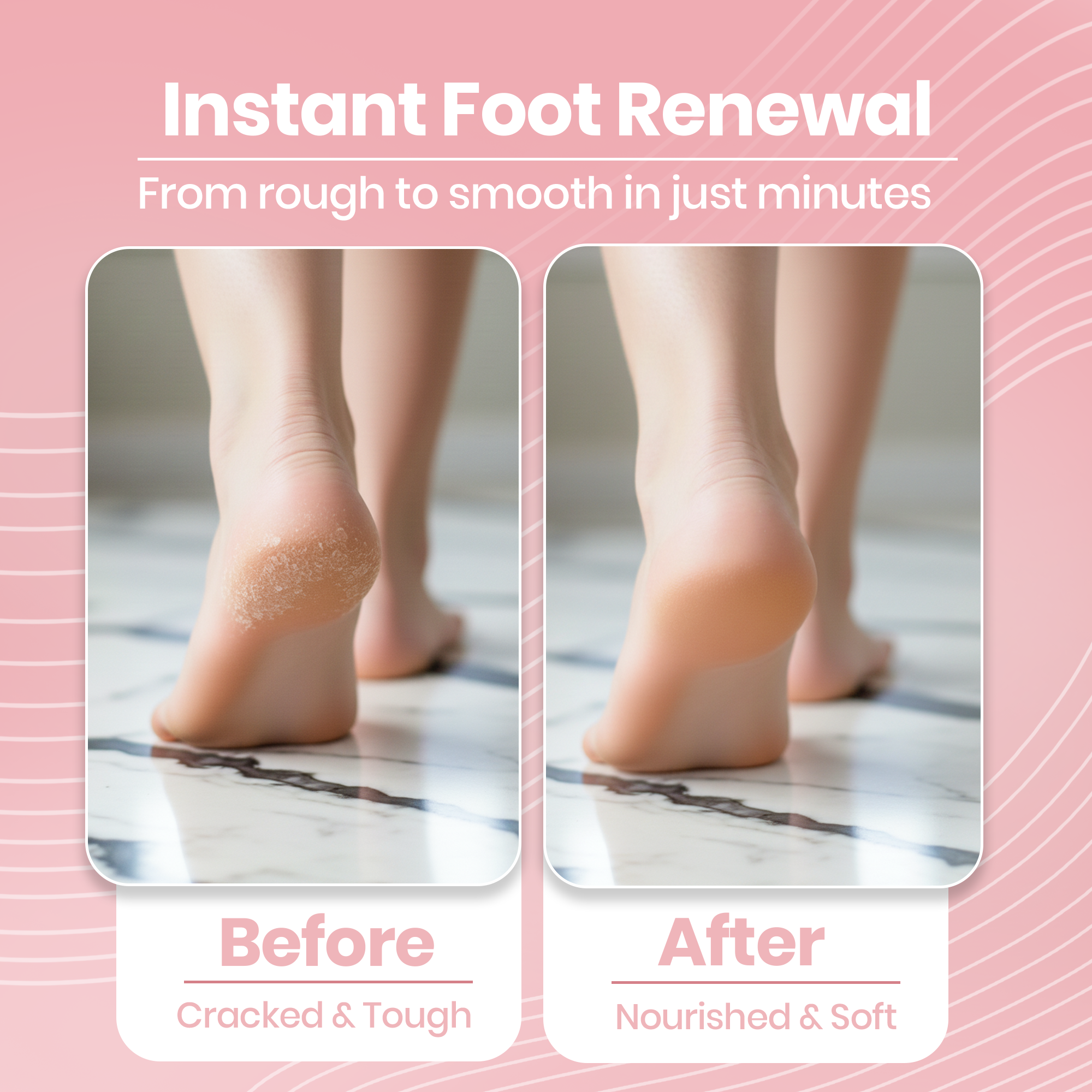 Instant Foot Renewal - Before and After